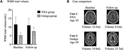 Naoxin’an capsules protect brain function and structure in patients with vascular cognitive impairment